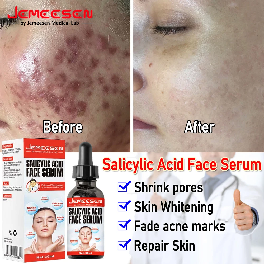 Salicylic Acid Face Essential Oil Shrink Tighten Pores Repair Skin Fade