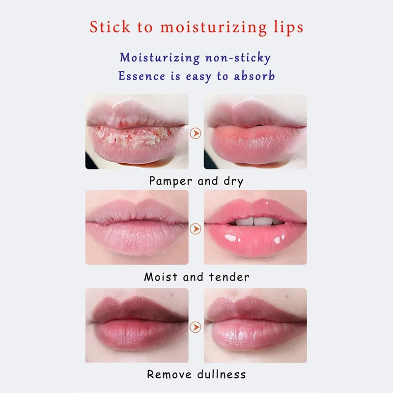 Remove Dark Lip Balm Lighten Melanin Long Lasting Nourishing Waterproof Lip Mask Lip Moisturizing Anti-dry Lip Care Products 3