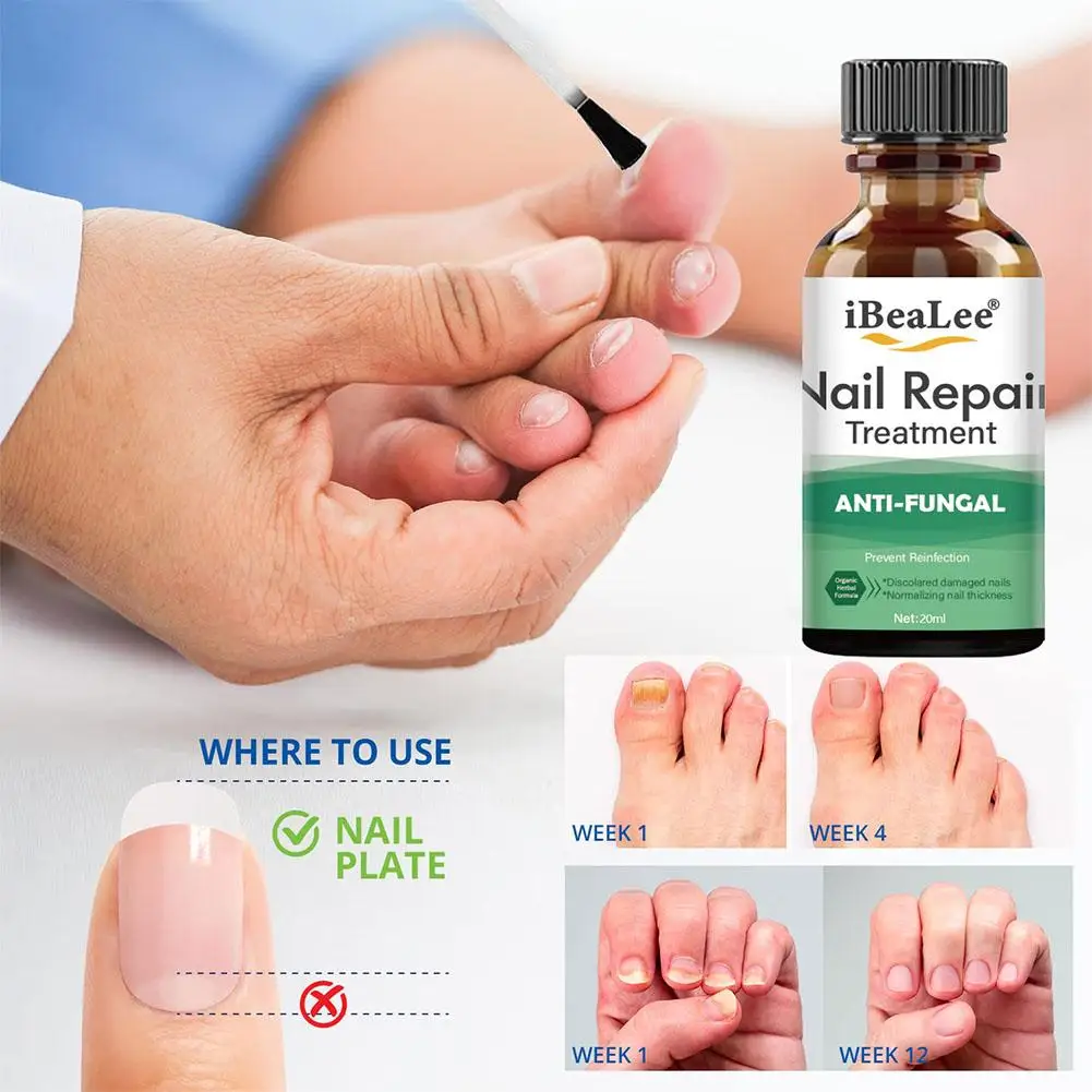 20ml Nail Solution Hand And Foot Thickening Type Gray Cleaning Soft Nail Gray Solution Nail Nail Bright Solution Nail P1S4