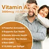 1723-752720.jpg BEWORTHS Vitamin A Capsules Effectively Antioxidant Skin Care Enhances Immunity and Supports Eye and Bone Health