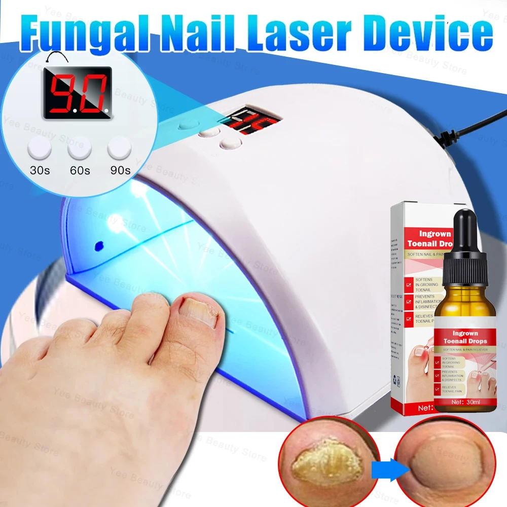 Fungal Nail Laser Device nail fungus remover personal health care laser therapy pen Nails Fungus Fast Repair Onychomycosis Toenail Fingernail Removes Nail Fungus Foot Care Cure Ingrown