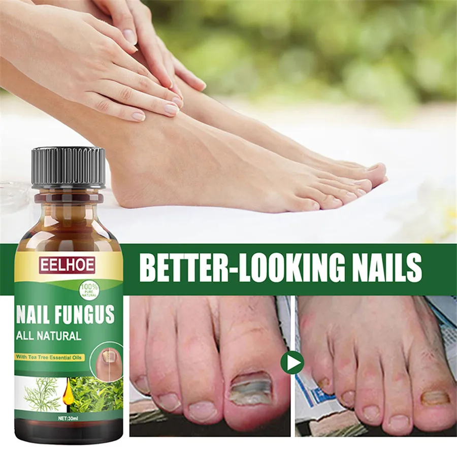 Toenail Tea Tree Oil Fungal Nail Treatment Bad Nails Thick Nails