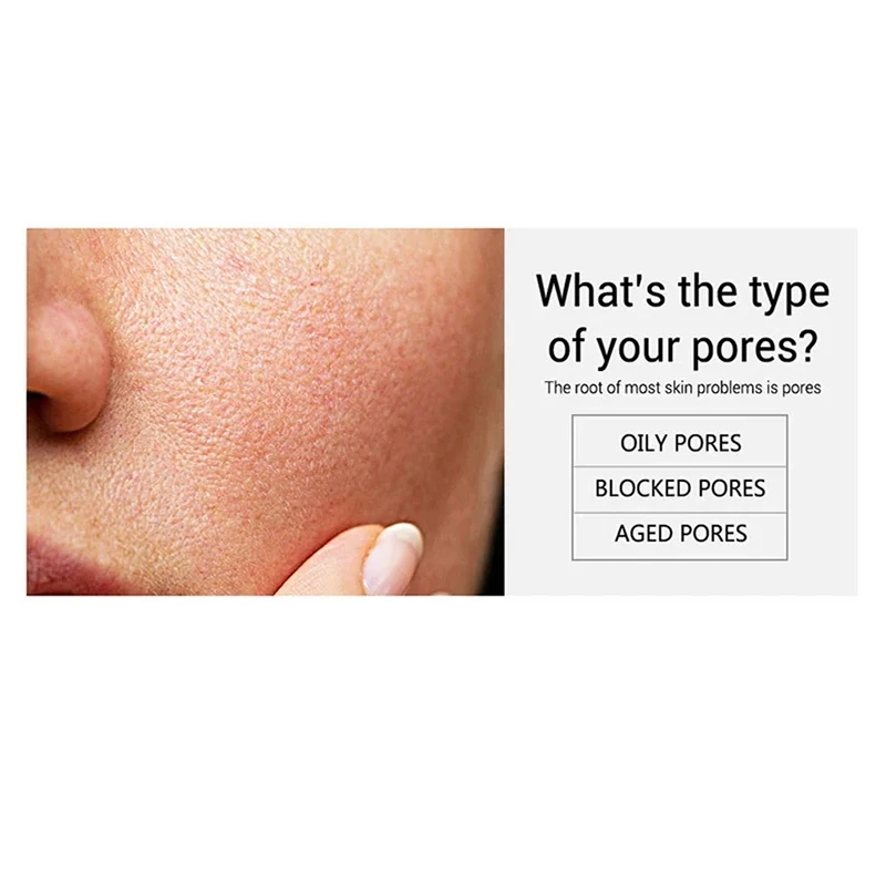 Description Picture 6 of itemSalicylic Acid Pore Shrinking Cream Quick Remove Blackehead Elimination Large Pores Tighten Face Smooth Skin Korean Care Product