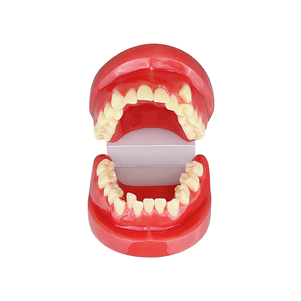 1pcs 치열 교정 모델 치과 티포돈트 턱 모델 환자 의사소통 교육 도구를 위한 치과 시연 제품