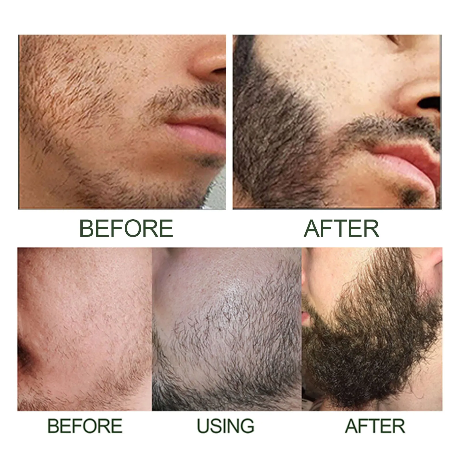 Kit Siero per la Crescita della Barba con Derma Roller 0.2mm, Attiva i Follicoli Piliferi, Ripara la Barba Danneggiata, Siero per Barba Più Folta e Spessa - immagine 3