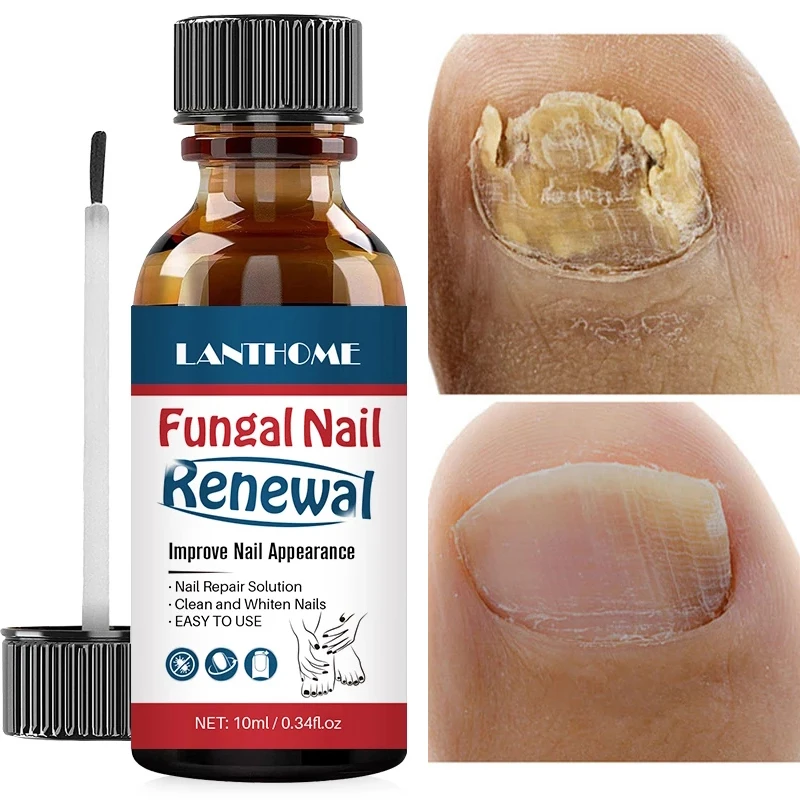 Nail Repair Fluid Anti Fungal Nail Polish Cleansing Nourishes Nails