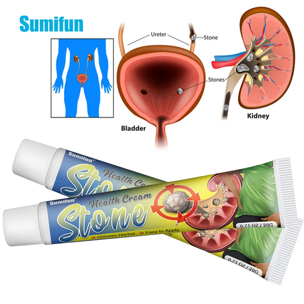 Sumifun Kidney Stones Removal Cream Treat Gallstones Renal Calculus