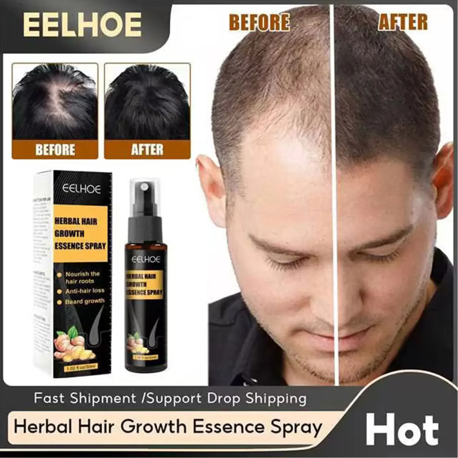 Description Picture 3 of itemSdatter Hair Growth Essence Spray Ginger Anti Hair Loss Treatment Scalp Dry Damaged Beard Regrowth Care Roller Set  Anti Falling