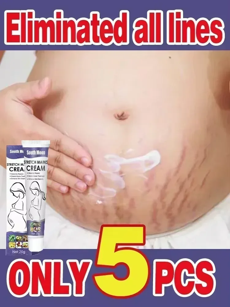 Permanent Removal Cream Eliminate Body Belly Stretch Marks For Tunnels Effective Stretch Marks Cream Removes body slimming cream