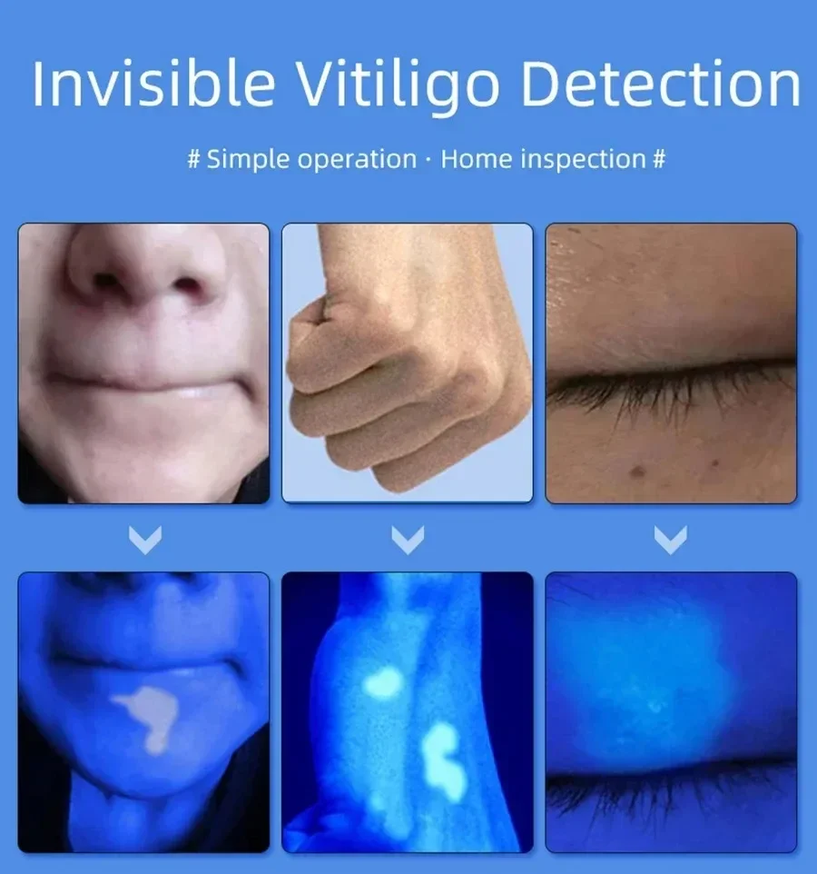 NEW Woods Lamp Skin Analyzer For Skin UV Magnifying For Beauty Facial Testing Wood Lamp Light Skin Analysis Detection Skin Care