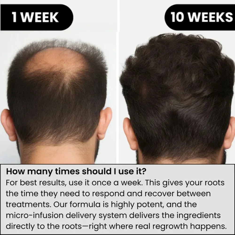 Hair Serum Gentle Nourishes the Scalp and Cares for the Softening Hair Care Daily Care Scalp Serum - 2
