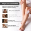 Face and Body Whitening Snow Bleach Cream Fast Bleaching Brighten Inner Thigh Cream Bleach for Intimate Area 5