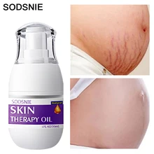 

30ml Skin Therapy Oil Improve Dullness Anti-Aging Remove Stab Wound Burns Cellulite Repair Stretch Marks Brighten Body Skin Care