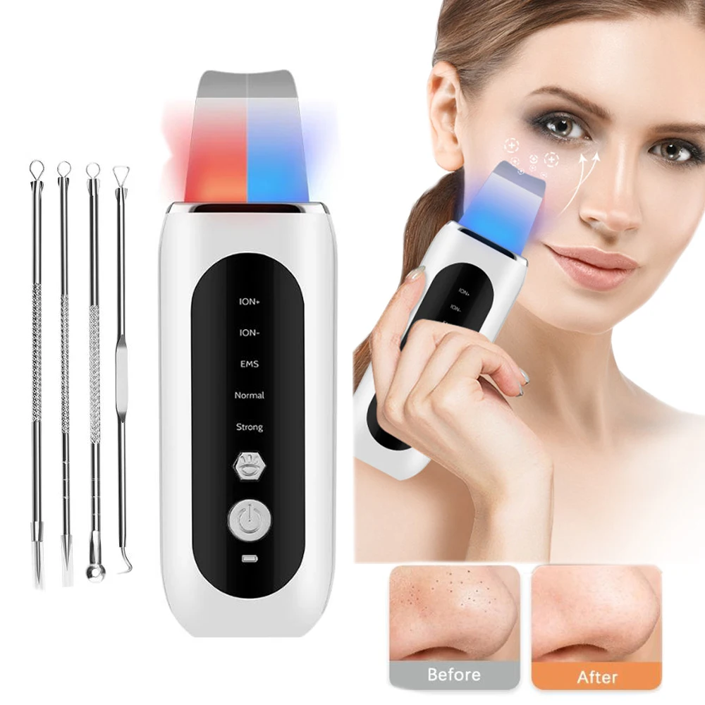 

Ultrasonic Skin Scrubber Peeling Blackhead Remover Deep Face Cleaning Ultrasonic Ion Ance Pore Cleaner Facial Shovel Cleanser