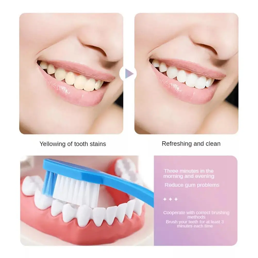 Dental Calculus Remover Teeth Whitening Essence Teeth Whitening Product Teeth Health Product 100g Nicotinamide Whitening Toothpaste Stains Tartar Removal Fresh Breath Oral Anti-Sensitive For Teeth Cleaning