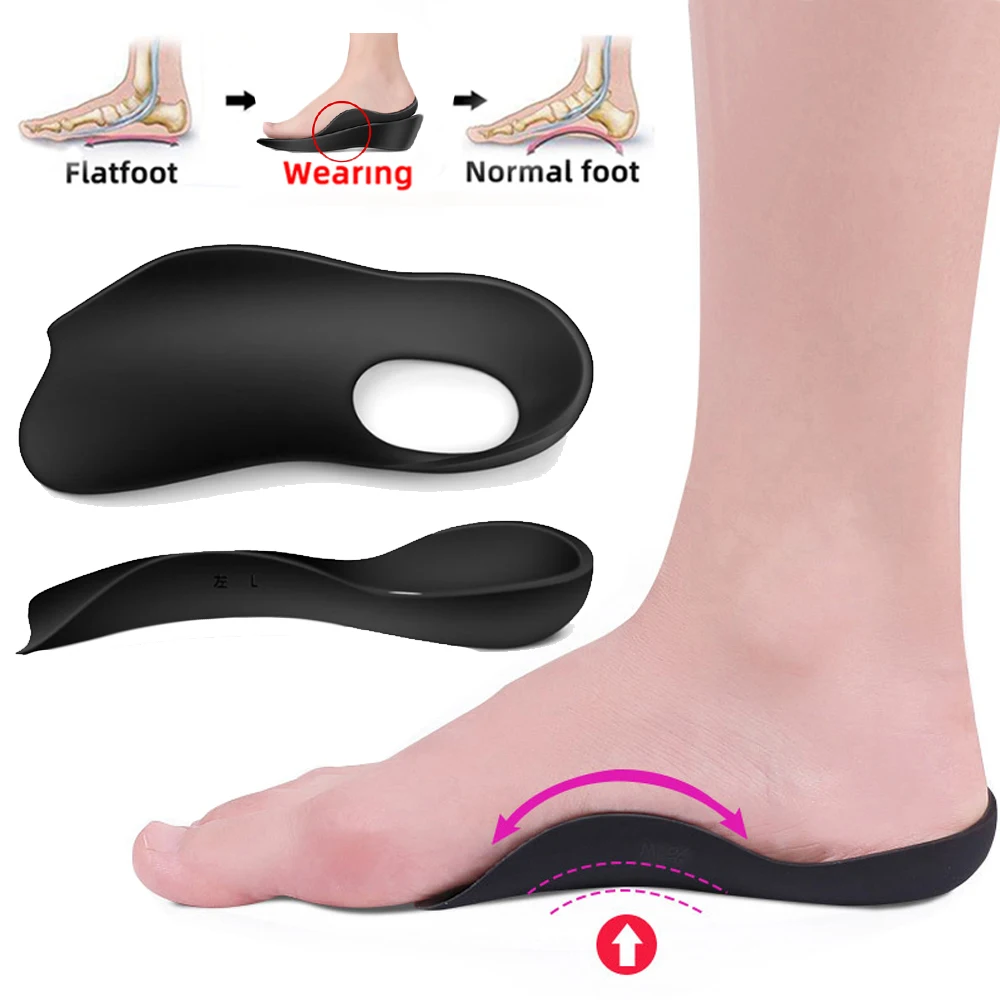 Orthotic-Insoles-For-XO-shaped-Legs-Corrector-Arch-Support-Plantar ...