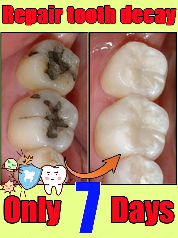 Family Teeth Cleaning Get Rid of Yellow Teeth Prevent Dental Problems