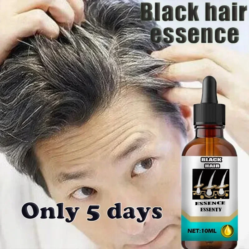 Tueur de cheveux blancs, &eacute;limine les cheveux gris et restaure la couleur naturelle en 7 jours