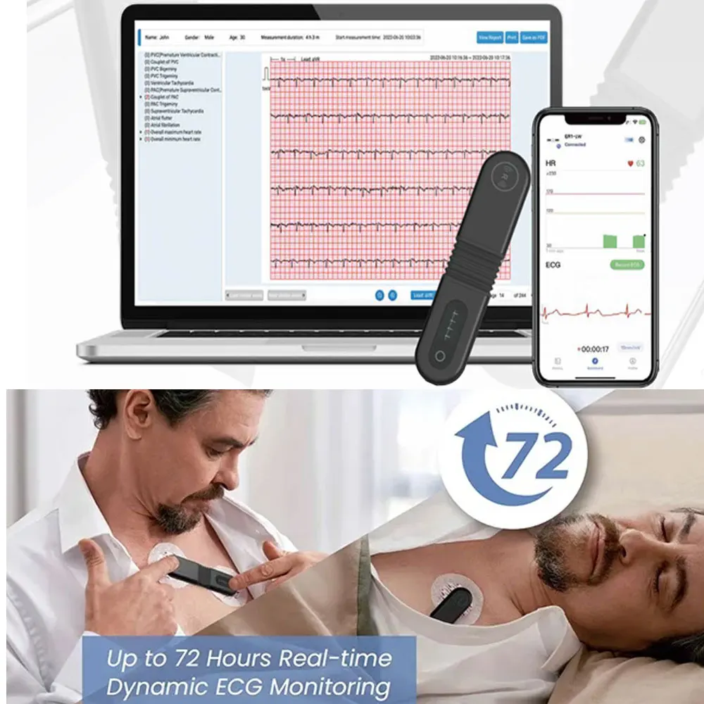 24 Hours Holter ECG,Wearable Bluetooth ECG, EKG,AI-ECG Analysis,Real-time Dynamic ECG Monito,Digital OLED Display