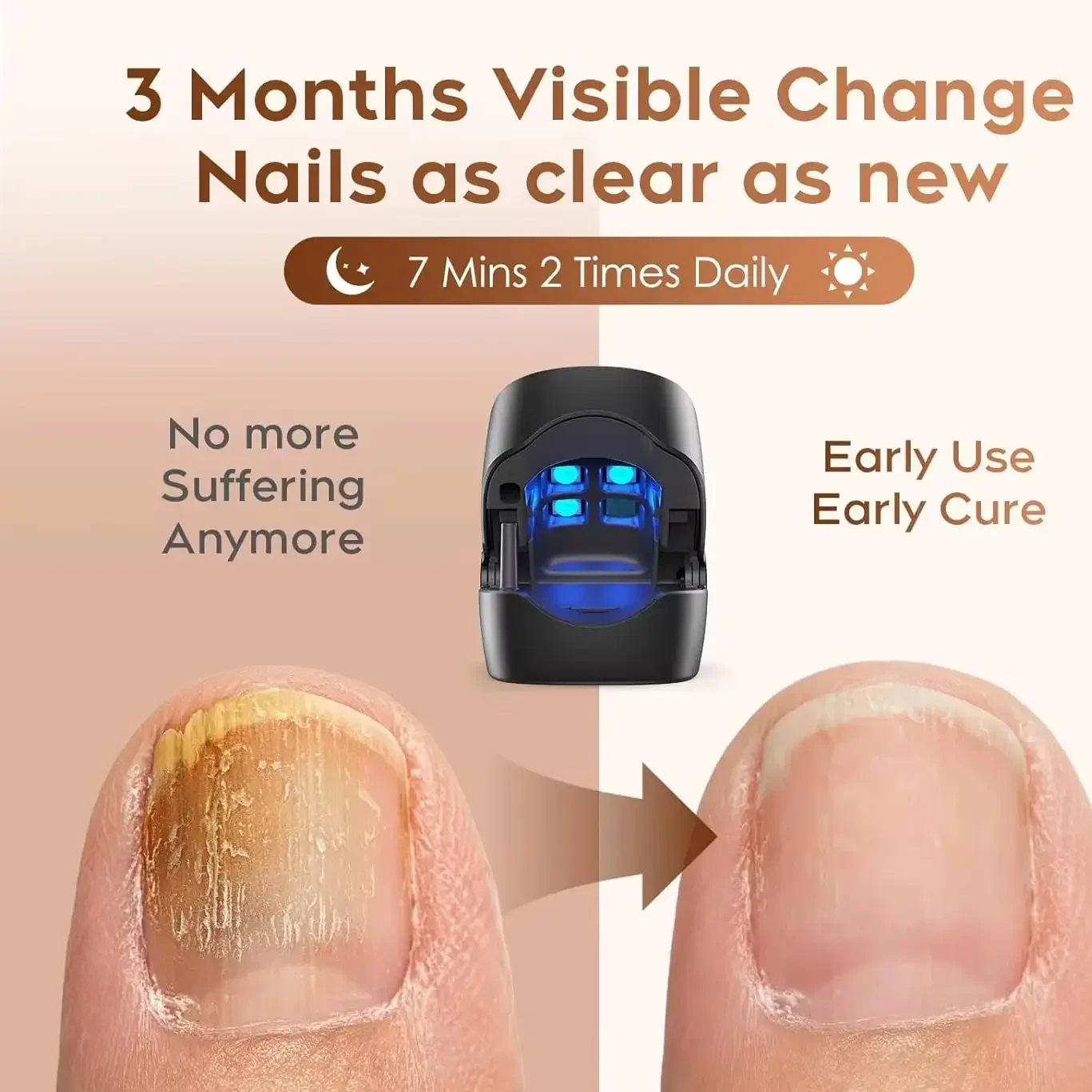 Nail Fungus Remover Laser Therapy Pen Nail Fungus Treatment Laser Device For Cleaning Onychomycosis USB Charge Anti Fungal Repair Damaged Discolored Thick Fingernails