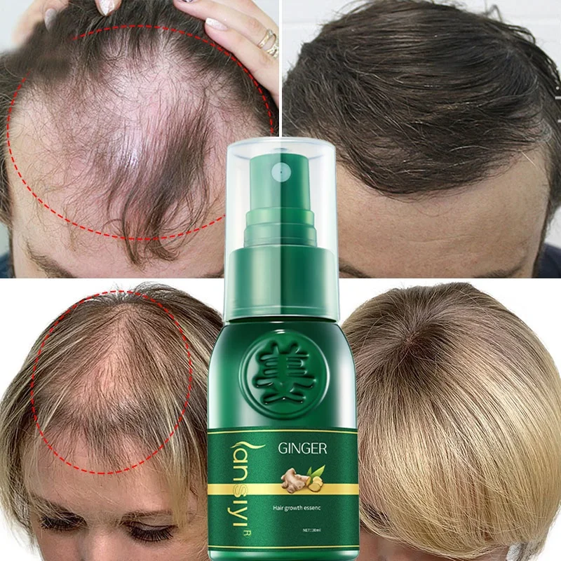 

Powerful Hair Growth Serum Ginger Spray Anti Hairs Loss Repair Nourish Hair Roots Products Fast Regrowth Hair Beauty Health Care