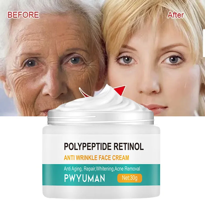 

Retinol Wrinkle Removal Face Cream Anti-Aging Firming Lifting Fade Fine Line Gel Moisturizing Whitening Korean Facial Skin Care