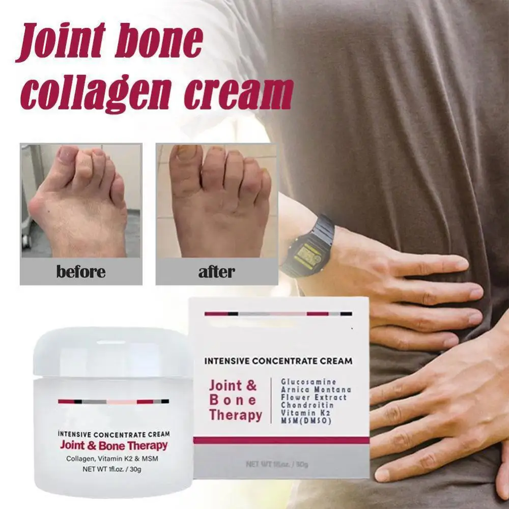 

30/50g Relieve Joint Pain Security Joint Treatment Cream Collagen Cream For Joint Bone Treatment Joint Cream Health Products