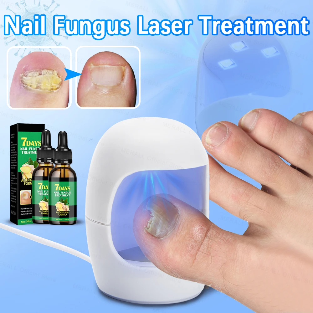 Nail Fungus Treatment Repair Toenail Fingernail Device Treat Toenail Nail Fungal Treatment Essential Oil Onychomycosis