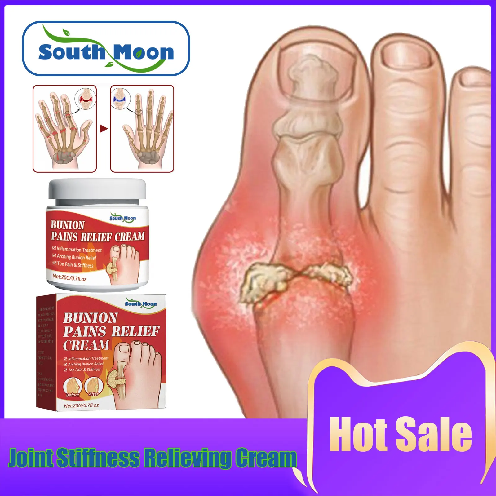 Bunion Gout Treatment Cream Relieve Lumbar Arthritis Pain Treating Limb Stiffness Toe Joint Valgus Corrector Joint Care Ointment