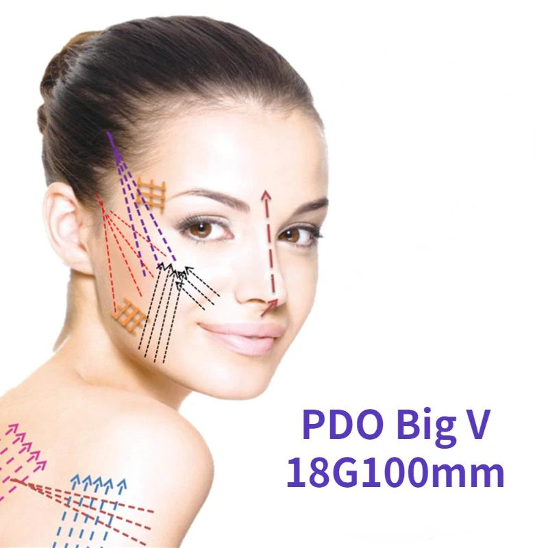PDO Big V 18G100mm 2022 Newest Pdo Korea Thread Lift Facial Neck Arm