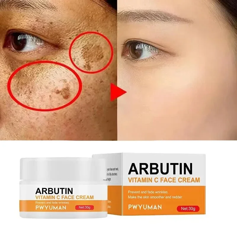 Vitamin C Whitening Freckles Face Cream Remove Melasma Melanin Fade Dark Spot Acne Marks Brighten Moisturizing Firming Skin Care