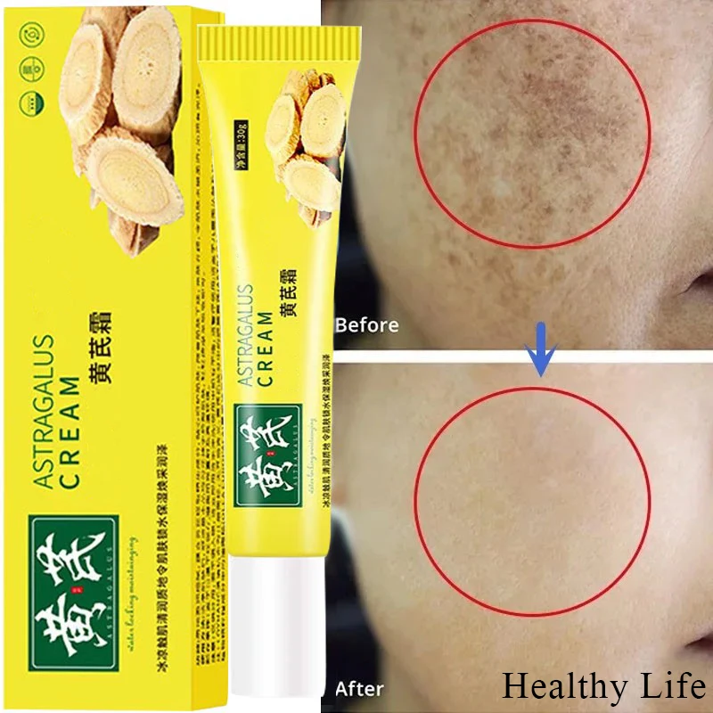 

Buy 1 Get 3 Astragalus Whitening Freckles Cream Fade Spots Brighten Cream Remove Melasma Reduce Fine Lines Face Anti-aging Serum