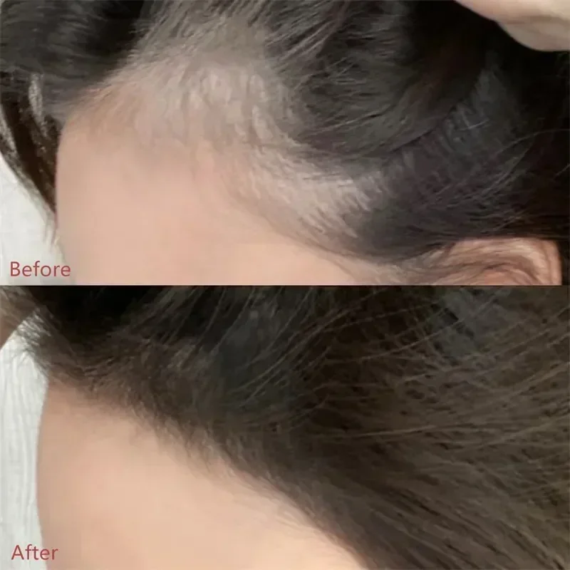 Hair Building Powder Magic Hairline Shadow Powder Makeup Hair Concealer Natural Cover Hair Loss Styling