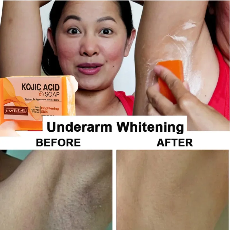 

Sdatter Kojic Acid Whitening Soap Dark Black Skin Lightening Soap Kojic Acid Glycerin Brighten Face Body Skin Bleaching Turmeric