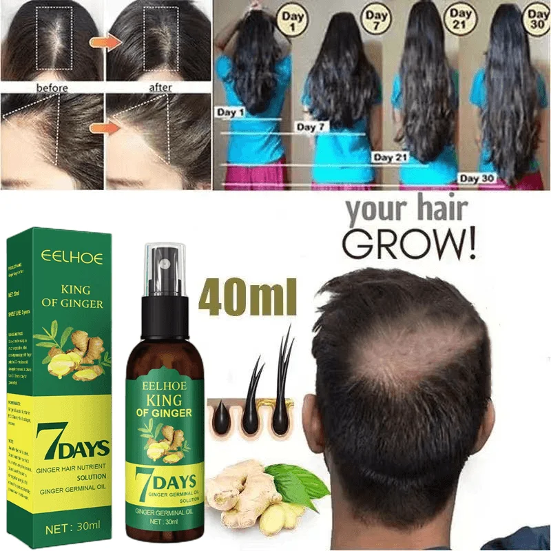 

2023 Ginger Hair Growth Serum Sprayer Hair Regrowth s Grow Thicker Longer Hair Accelerate Hair Growth For Men And Women
