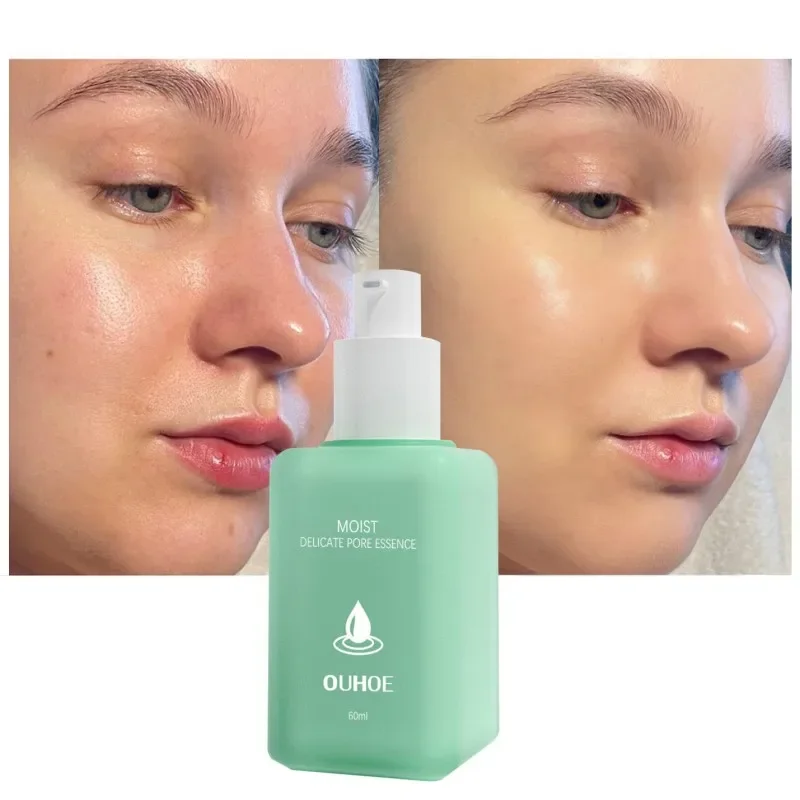 Lactose Acid Serum That Improves with Large Pores Facial Essence That Brightens Skin Gets Rid of Blackheads Acne Moisturizing