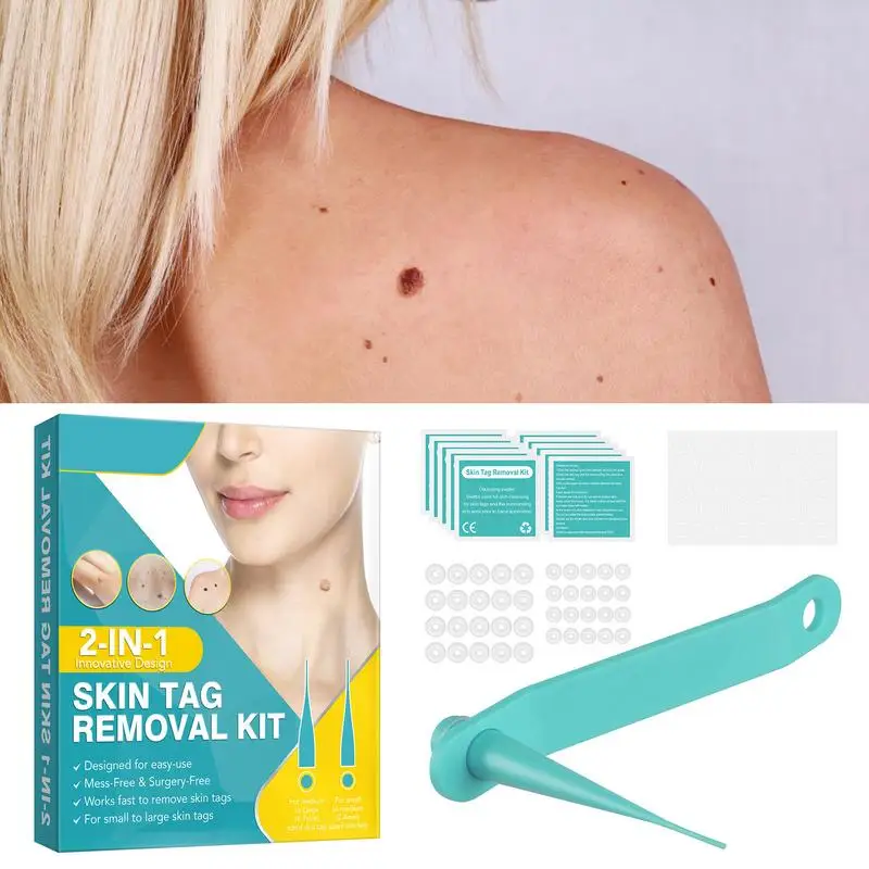 Skin Tags Removal Kit Painless Skin Tags Remover For All Skin Types Easy Skin Tags Remover Device To Remove Skin Tags Safe