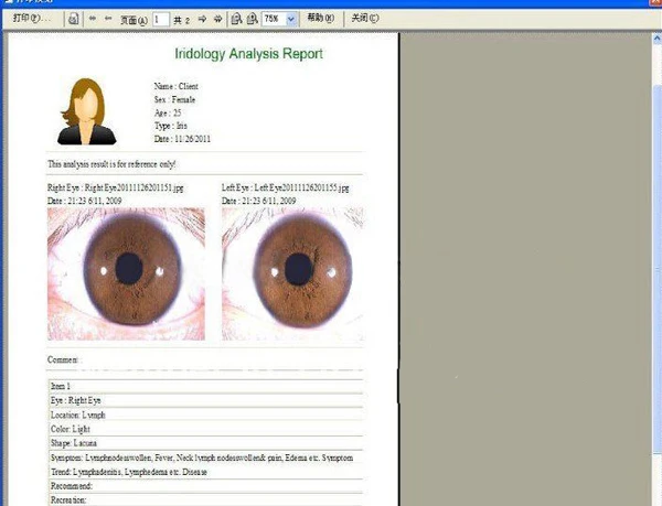 디지털 iridology 카메라 눈 이리스코프 iris 스캐너 5mp iris analyzer