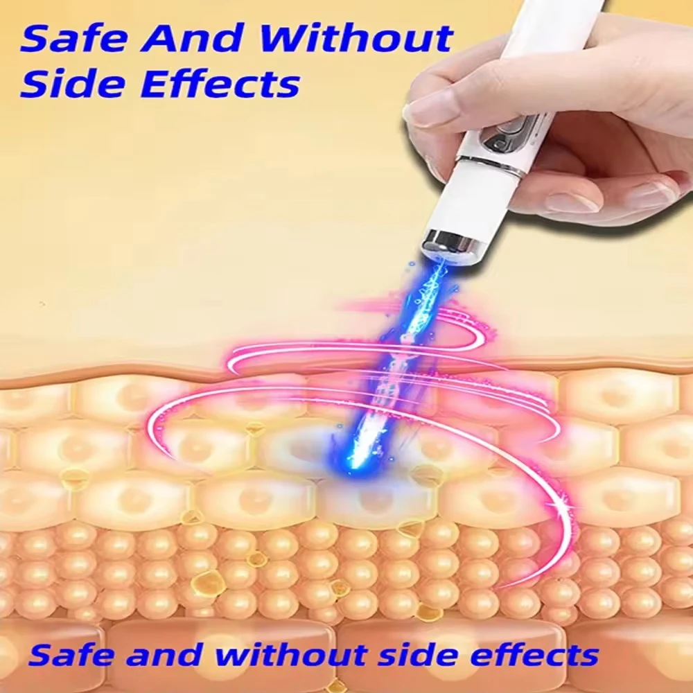 Scar Repair Gel Pen Treatment Improve Keloid Stretch Mark Whitening Body Care