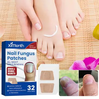 Nail Repair Patches Toenail Fungus Patch Sticky Toenail Nail Correction Ingrown Patch 32 Care Treatment Nail Paronychia Sti R9D5