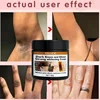 Body Whitening Cream Private Parts Underarm Bleaching Serum Whiten Butt Knee Brighten Inner Thigh Intimate Dark Remove Melanin 4
