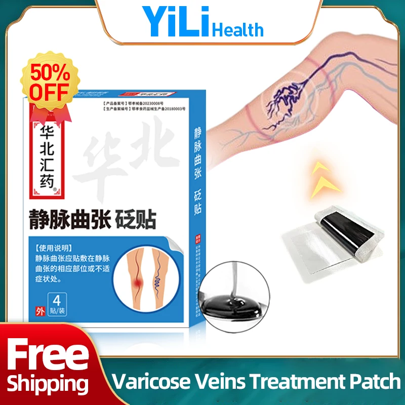 

Varicose Veins Treatment Patch Spider Legs Removal Varicocele Vein Vulvar Varicosity Repair Vasculitis Phlebitis Medicine