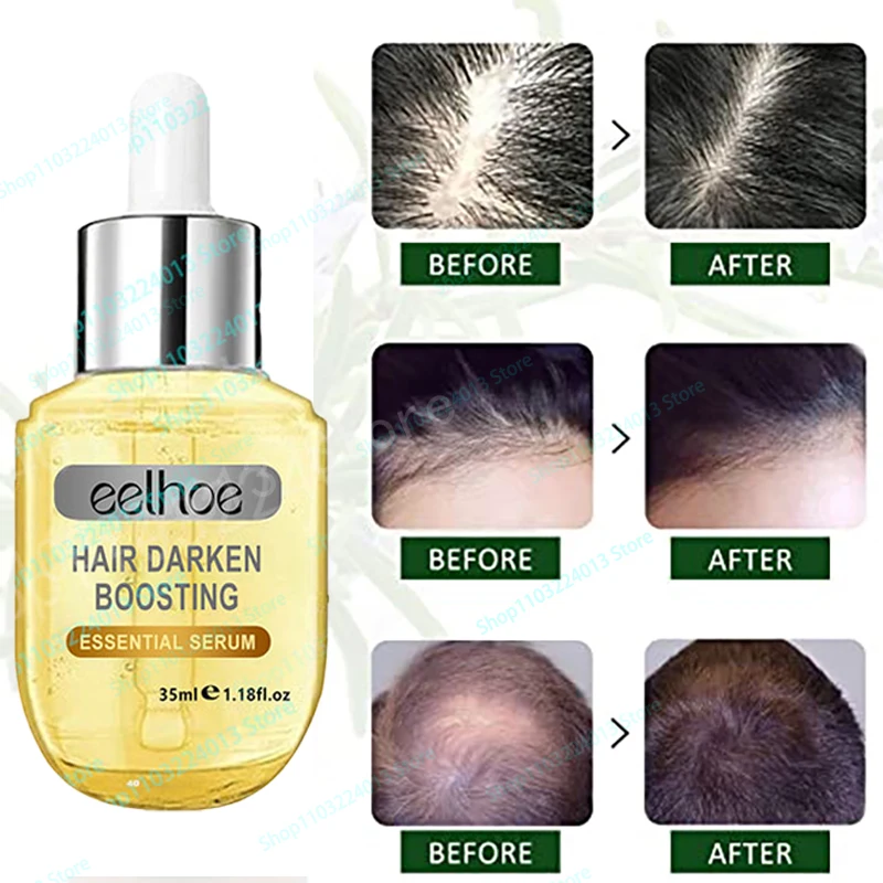 

Fast Hair Growth Oil Hair Regrowth Serum Hair Thinning Treatment Hair Growth Liquid Anti-Hair Loss For Women And Men