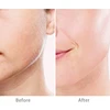 Generation 3 Replacement Heads For Finishing Touch Flawless Facial Hair Remover Double Precision Replacement Blades 5