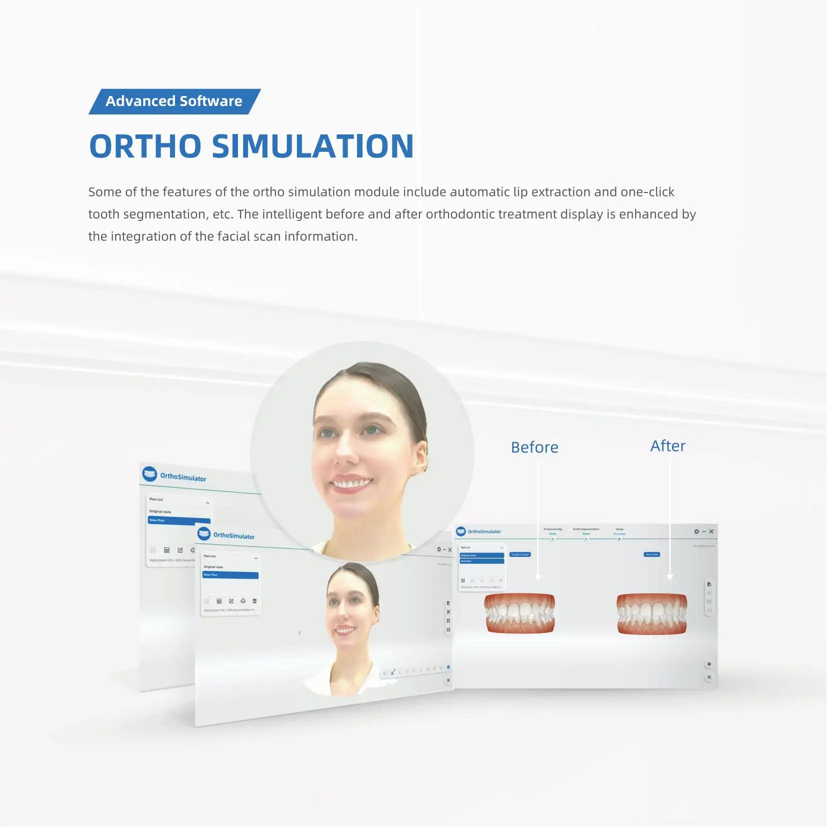 Рисунок 5 - Сканер для лица 3D MetiSmile Dental