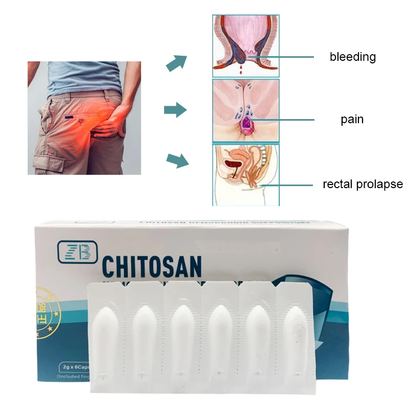 Hemorrhoid Ointment Treatment Internal And External Hemorrhoids And Anal Bleeding Relieve Swelling Pain herbal hemorrhoid treatment