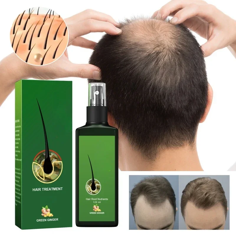 Zenzero naturale Cura dei capelli Olio essenziale Radice Crescere Anti perdita di capelli Siero Liquido Cuoio capelluto Danneggiato Trattamento Riparazione Prodotti per la cura - immagine 3