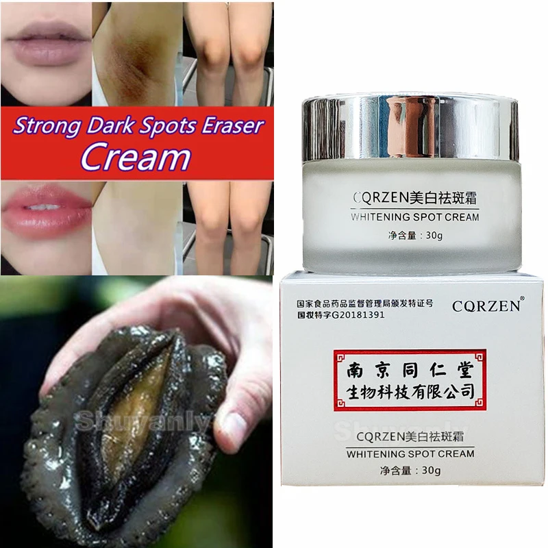 Intimate Area Inner Thigh Lightening Underarm Cream Whitening Anti-freckle Dilute, Strong Dark Spots Eraser, Spotless Skin Care private area whitening cream removing pigment precipitation moisturizing brightening intimate area underarm joint skin care 30ml