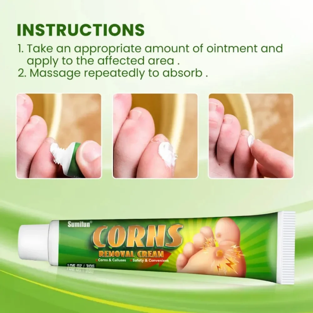 Foot Corn Remover Cream Chicken Eye Skin Infection Treatment Ointment Feet Dead Skin Calluses Removal Tool Health Care 30g
