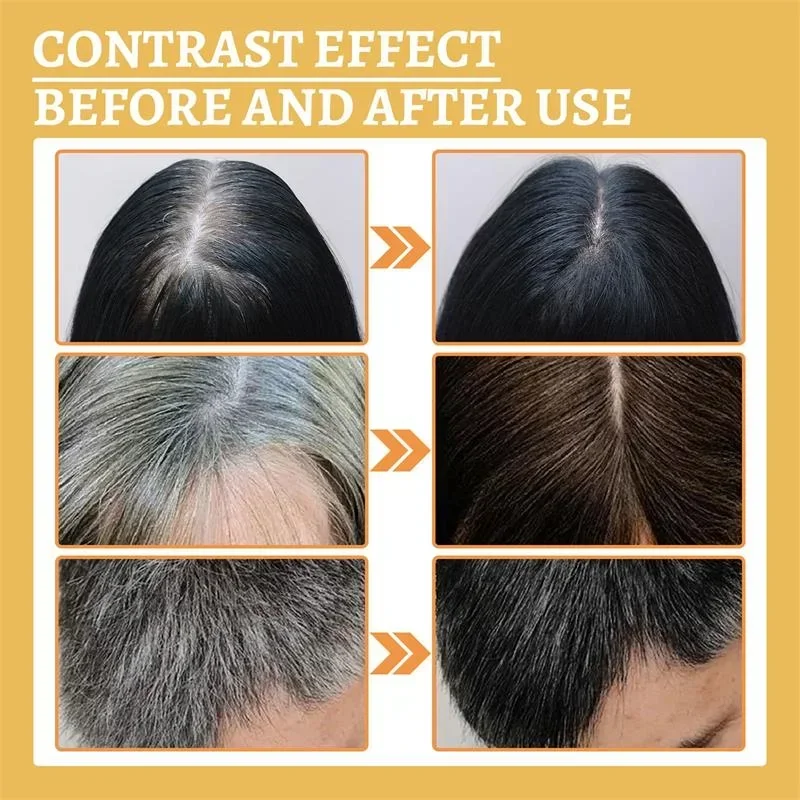 Hair Care Gray White Hair Treatment Serum Liquid White To Black Scalp Dry Damaged Beard Essential Oils Repair Nourish Product Hair Treatment Oil Scalp Treatment